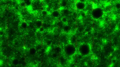 A pseudomonas aeruginosa biofilm, featuring dark circles pockmarking the surface. 