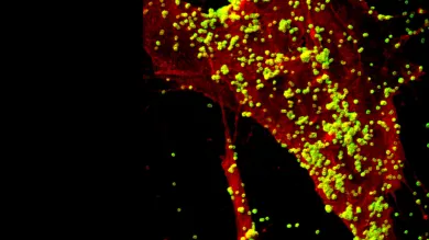 Infection research