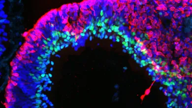 a human stem cell derived retinal organoid stained with antibodies for RECOVERIN (red, =photoreceptors) and AP2 (green, = amacrine cells). The lamination of the tissue and position of the cells is similar to a human retina. 