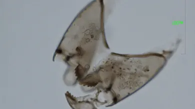 Chironomid (fossil insect remains) seen under light microscope