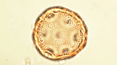 Pollen grain seen under light microscope