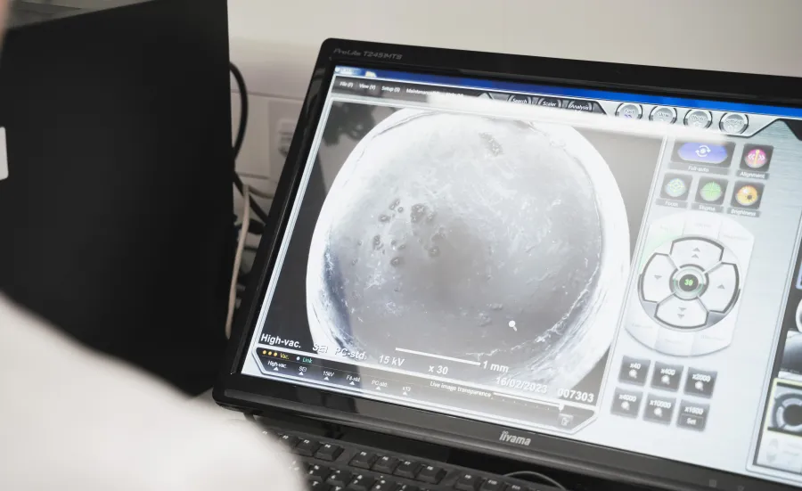 Viewing a microplastic sample in the SEM