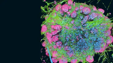 Oesophageal cancer associated fibroblasts