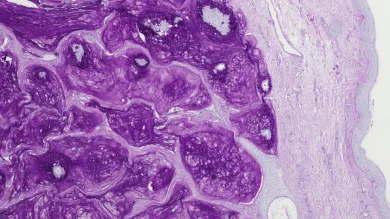 Purple tinted cells under a microscope