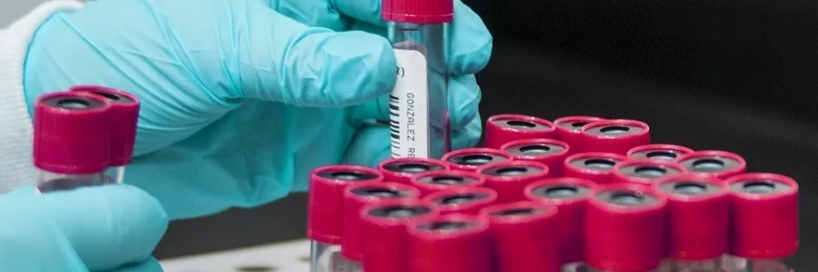 Close up of gloved hands placing specimen tubes into a tray