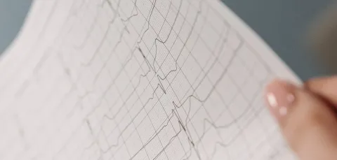 A person is holding an ECG or Electrocardiogram result on a piece of paper. We see their hand holding it up.