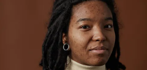 A close-up of a young black woman with acne, wearing a beige turtleneck shirt and looking directly at the camera.