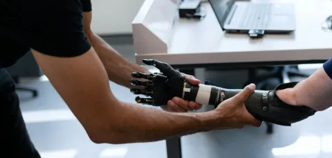 A patient has a prosthetic arm fitted