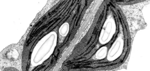 Monochrome electron micrograph showing detailed striated muscle fibers with visible mitochondria, set against a granular cytoplasmic background