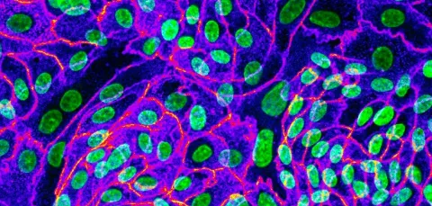Microscopic image of cells with green nuclei, blue cytoplasm, and red lines.