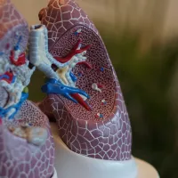 Image of a scientific model of a pair of lungs.