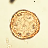 Pollen grain seen under light microscope